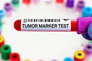 تشخیص بیومارکر چند نوع سرطان با یک آزمایش خون فوق حساس