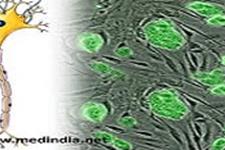 سلول درمانی با استفاده از سلولهای بنیادی مزانشیمی نویدی برای درمان MS پیشرونده