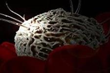 امید به استفاده از سلولهای بنیادی برای مبتلایان به سرطان