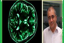 دانشمند ايراني دانشگاه «استفورد» موفق به كشف عامل ژتيكي تسريع زوال مغز شدن