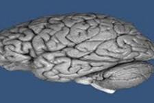 تحقیقات مغناطیسی برای سلامت بیشتر مغز