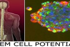 پیوند سلول های بنیادی نخاع انسان به موشهای مبتلا به ALS با ترکیب سرکوب گرهای ایمنی نتیجه بهتری دارد