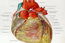 استفاده از سلول های بنیادی برای ایجاد عضله قلب