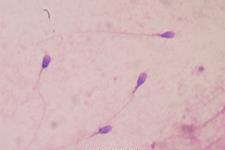 تبدیل سلول های بنیادی به سلول های اسپرم
