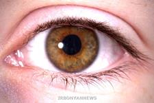 موفقیت سلول های بنیادی در درمان آسیب ها ی چشمی