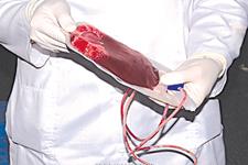خون بندناف کودکان مبتلا به بیماری های ژنتیکی را ذخیره کنیم