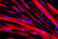 پیوند سلول های بنیادی بیماران مبتلا به دیستروفی عضلانی به موش