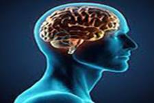درمان آنوریسم های مغزی بصورت اندووسکولار (درون رگ) برای نخستین بار در جنوب کشور
