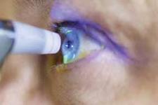 درمان نابینایی با سلول‌های چشم مردگان