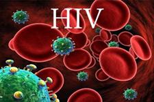 عملکرد ویروسHIV در سلول های بنیادی خاص