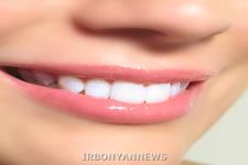 افزایش میزان موفقیت ایمپلنت های دندان