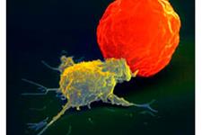 کنترل سلول های کشنده سرطان توسط فرآیندهای اپی ژنتیکی