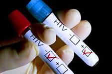 کشف ژنی که از گسترش HIV جلوگیری می کند