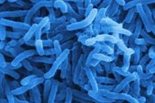 کلید ژنتیکی غلبه بر وبا