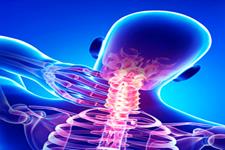 پروتئین Nanog عامل رشد سرطان سر و گردن