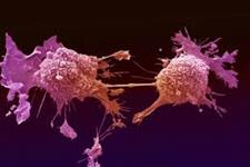 کشف منبع انرژی جدیدی برای سلول های سرطانی