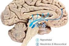 مطالعات دارویی برای بیماری پارکینسون: رشد نورون ها در محیط سه بعدی
