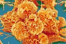 کشف زمان آسیب پذیری سلول های سرطانی متاستاز دهنده