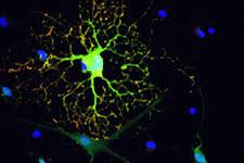 میلینه کردن مجدد مغز بوسیله  پیش سازهای اولیگودندروسیتی مشتق از سلول های بنیادی جنینی