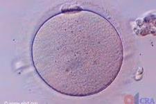 ساخت پیش سازهایی برای اسپرم و تخمک انسانی