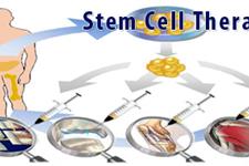 اثرات سودمند استفاده از سلول درمانی برای انواع بیماری های خطرناک(2)