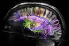 کشف یک نقش غیر منتظره برای سلول های بنیادی در مغز