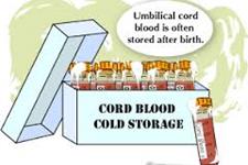 سلول درمانی از طریق بانک های خون بند ناف مقرون به صرفه تر است
