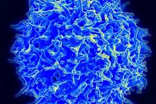 موفقیت در سلول درمانی برای جلوگیری از عفونت بعد از پیوند با استفاده از سلول های T