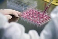 موفقیت محقق ایرانی در جداسازی سلول‌های بنیادی از بافت چربی