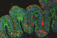 تولید بافت معده از سلول های بنیادی جنینی موش 