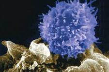 ایمنی درمانی جدید بر مبنای سلول های T برای درمان اختلالات کشنده پیوند سلول های بنیادی امیدواری هایی را نشان می دهند