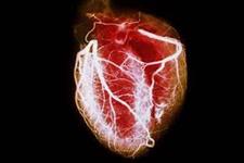 تولید سلول های قلبی مختص بیمار از سلول های بنیادی