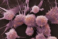 شناسایی سوئیچ اصلی پروتئین HER2 عامل سرطان 