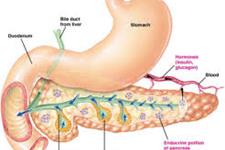 سلول های بنیادی سرطان پانکراس ممکن است به وسیله داروهای ضد دیابتی از بین بروند