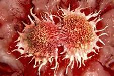 شیوه جدید دفاعی سلول های سرطانی 