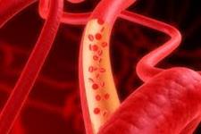 رشد عروق خونی در یک هفته از سلول های بنیادی مشتق از خون بیمار