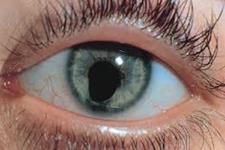 اطلاعات جدید در مورد تکوین چشم و نقش سلول های بنیادی در این فرایند