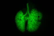 کشف مکانیسم سلولی که طی عفونت های شدید از ریه محافظت می کند