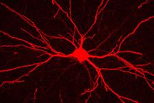 کشف راهی نوین در افزایش رشد عصب پس ازآسیب 