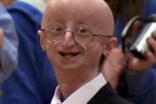 استفاده از سلول های بنیادی پرتوان القا شده برای شناسایی مکانیسم های دخیل در بیماری Progeria(پیری زودرس در کودکان)