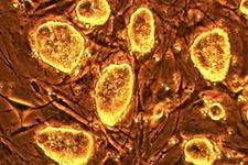 سلول های بنیادی جدید ممکن است بر مشکلات طب ترمیمی غلبه کنند(خبر تکمیلی)