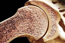 ایمپلنت های پرینت شده سه بعدی به رشد استخوان واقعی کمک می کند