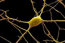 ویژگی های ذاتی سلول ها که روی سرنوشت سلول های بنیادی عصبی اثر می گذارد