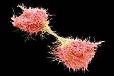 آنتی بادی که پروتئینی را روی سطح سلول های بنیادی هدف قرار می دهد، پروتئینی مشابه را نیز روی سلول های سرطانی هدف قرار می دهد