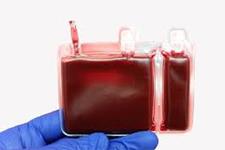 کارآزمایی های بالینی حاکی از موثر بودن خون بند ناف برای درمان سکته است