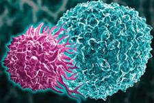 دستورالعمل هایی برای مدیریت کردن عوارض جانبی CAR T cell درمانی