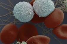 ساخت سلول های بنیادی خونی از سلول های خود بیمار