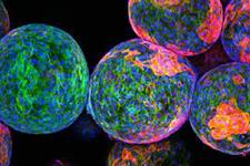 زیست ماده ای جدید که می تواند سلول های تولید کننده انسولین را بعد از ایمپلنت شدن محافظت کند