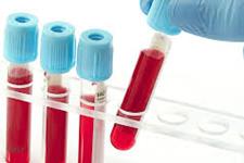 افزایش دفعات اهداء خون عوارض جانبی مهمی ندارد