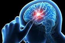 تحریک مغزی همراه با سلول بنیادی عصبی بالغ، ممکن است ریکاوری سکته را سرعت ببخشد